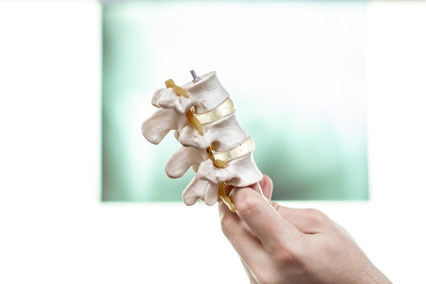 un médico sostiene un modelo de médula espinal en un hospital de houston